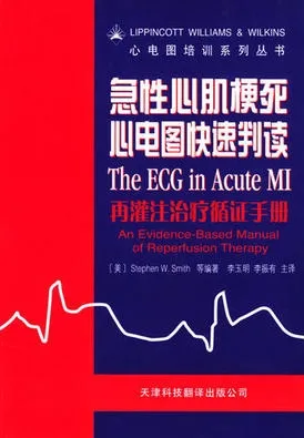 急性心肌梗死心电图快速判读：再灌注治疗循证手册