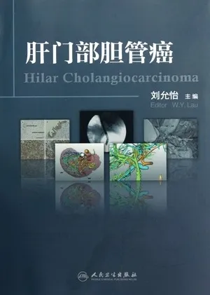 肝门部胆管癌