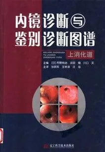 内镜诊断与鉴别诊断图谱