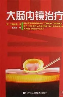 大肠内镜治疗