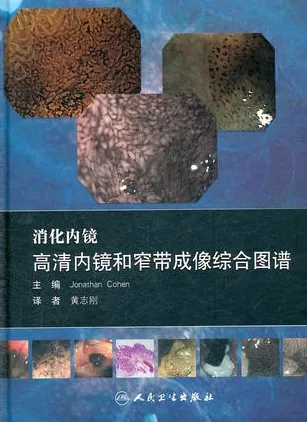 消化内镜 高清内镜和窄带成像综合图谱