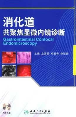 消化道共聚焦显微内镜诊断