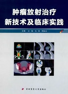 肿瘤放射治疗新技术及临床实践