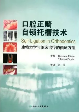 口腔正畸自锁托槽技术 生物力学与临床治疗的循证方法