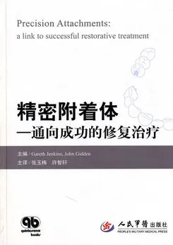 精密附着体 通向成功的修复治疗