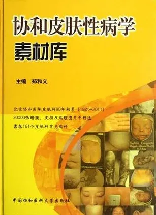 协和皮肤性病学素材库