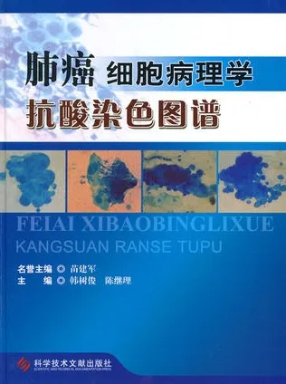 肺癌细胞病理学抗酸染色图谱