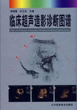 临床超声造影诊断图谱