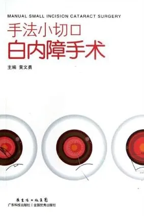 手法小切口白内障手术