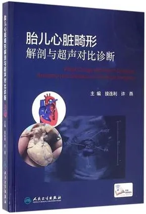 胎儿心脏畸形解剖与超声对比诊断