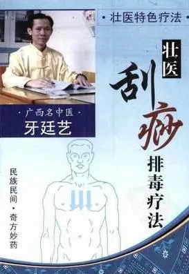壮医特色疗法 壮医刮痧排毒疗法