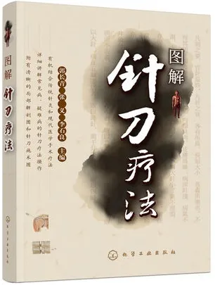 图解针刀疗法