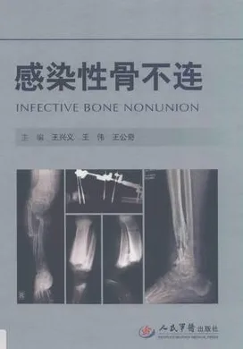 感染性骨不连
