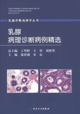 乳腺病理诊断病例精选