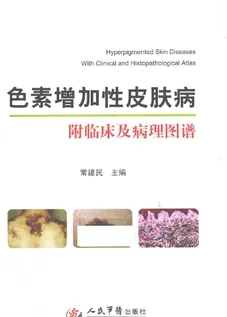 色素增加性皮肤病 附临床及病理图谱