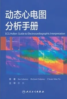 动态心电图分析手册