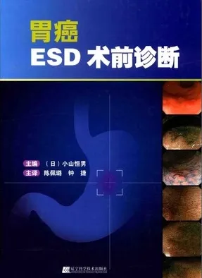 胃癌ESD术前诊断