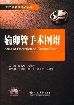 输卵管手术图谱