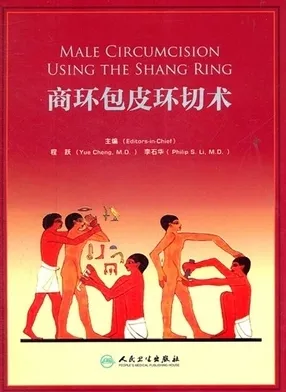 商环包皮环切术