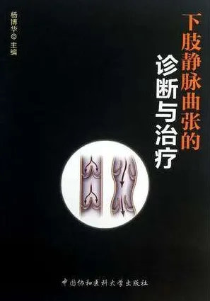 下肢静脉曲张的诊断与治疗