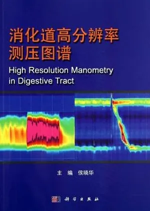 消化道高分辨率测压图谱