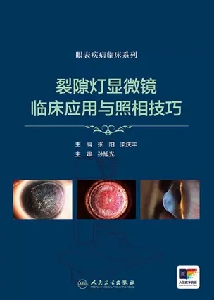 裂隙灯显微镜临床应用与照相技巧