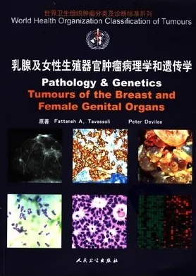 WHO肿瘤分类 乳腺及女性生殖器官肿瘤病理学和遗传学