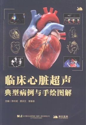 临床心脏超声典型病例与手绘图解