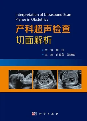 产科超声检查切面解析