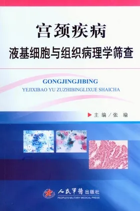 宫颈疾病液基细胞与组织病理学筛查