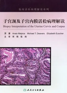 子宫颈及子宫内膜活检病理解读