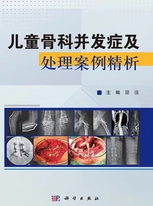 儿童骨科并发症及处理案例精析