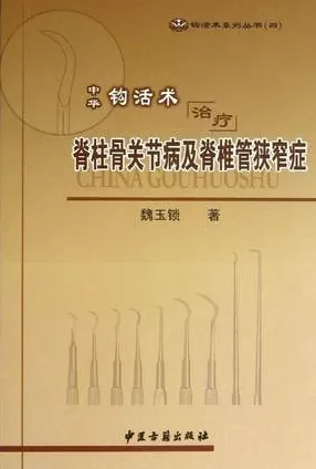 中华钩活术治疗脊柱骨关节病及脊椎管狭窄症