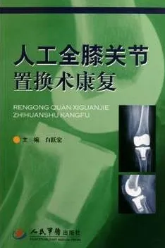 人工全膝关节置换术康复