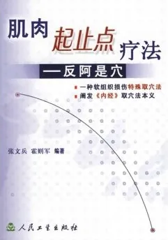 肌肉起止点疗法 反阿是穴
