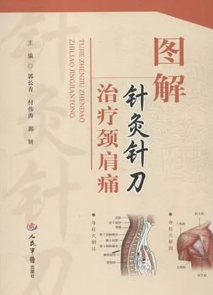 图解针灸针刀治疗颈肩痛