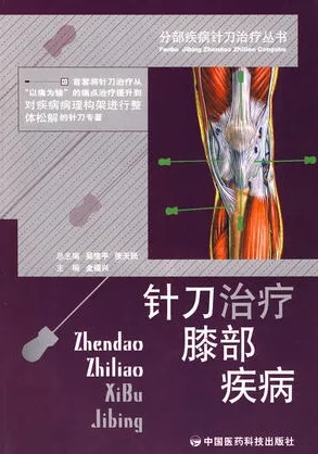分部疾病针刀治疗丛书 针刀治疗膝部疾病