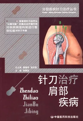 分部疾病针刀治疗丛书 针刀治疗肩部疾病