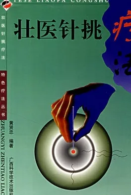 壮医针挑疗法