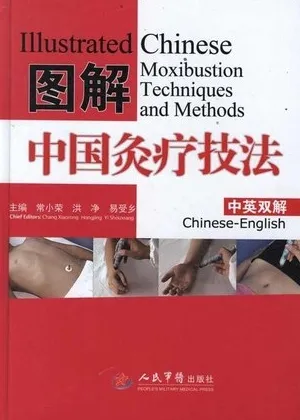图解中国灸疗技法（中英双解）