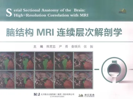 脑结构MRI连续层次解剖学