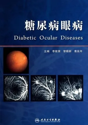 糖尿病眼病